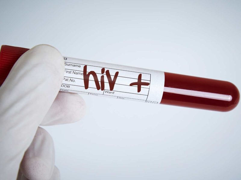 Biaya Tes HIV di Puskesmas