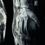 Radiologi Muskuloskeletal