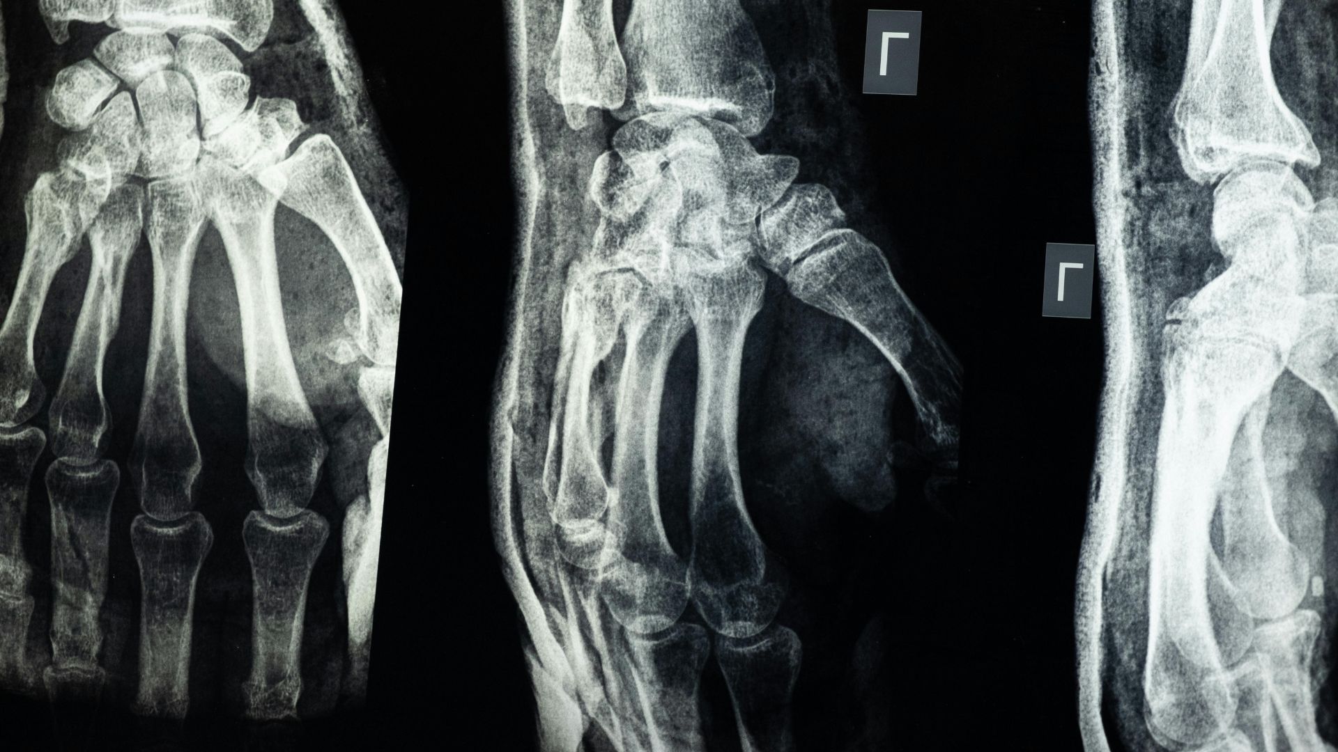 Radiologi Muskuloskeletal